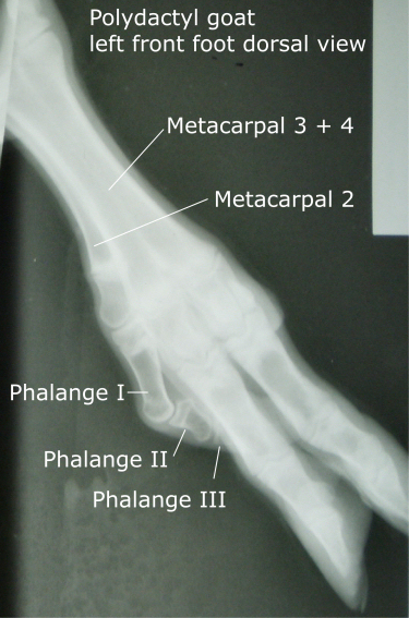 xray of polydactyl leg